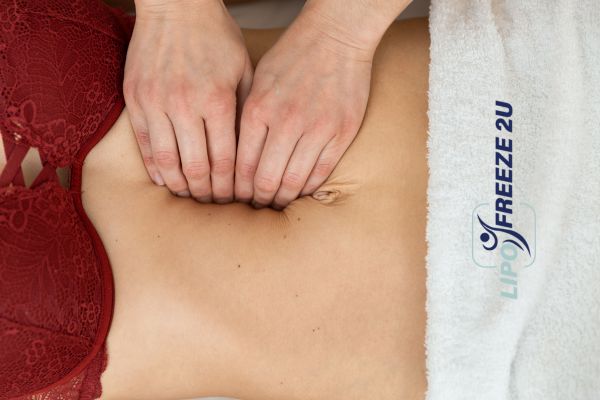 diastasis recti treatment Edmonton