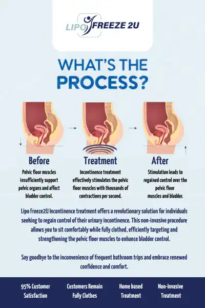 Diagram of how incontinence treatment Edmonton works.