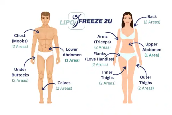 Areas you can have fat freezing treatment Edmonton