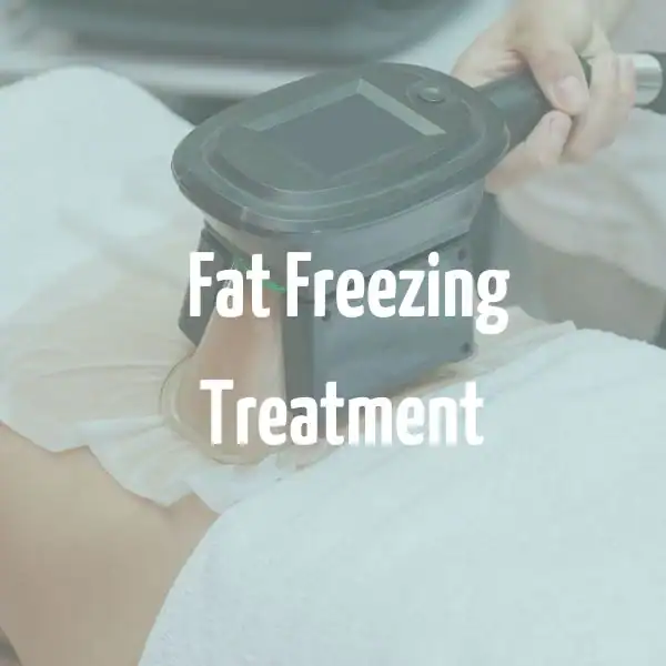 fat freezing treatment Edmonton