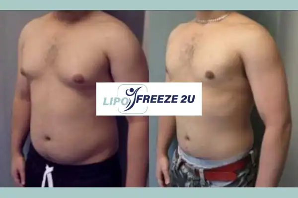 How Long Does It Take to See Results Edmonton?