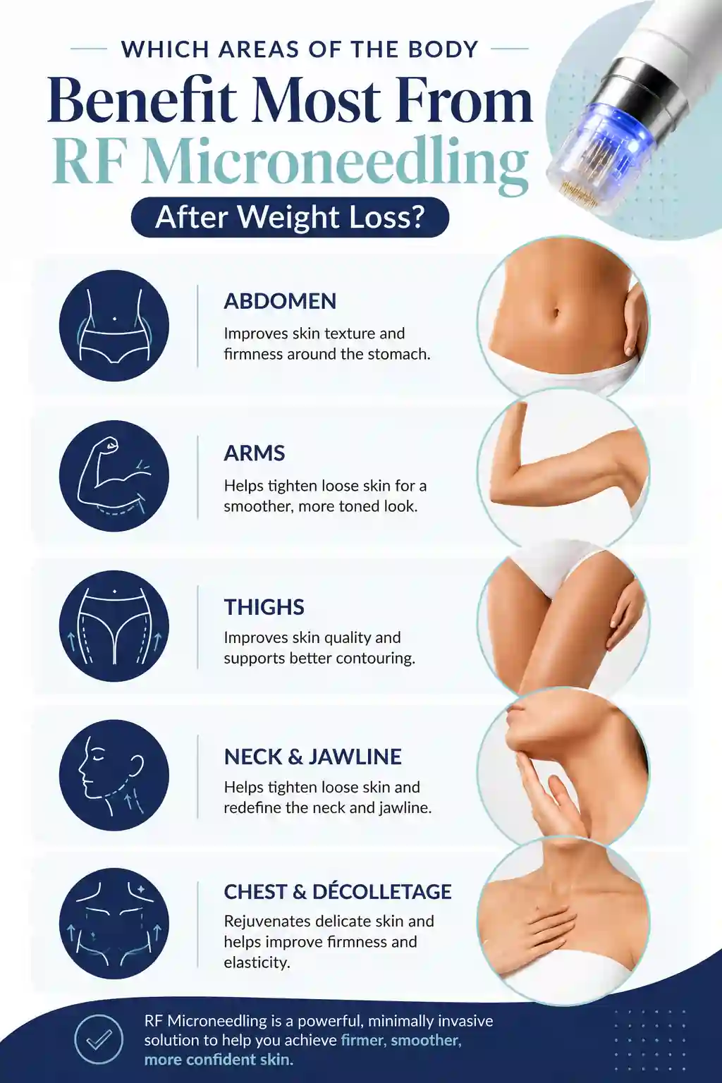 Which Areas of the Body Benefit Most From RF Microneedling After Weight Loss Edmonton